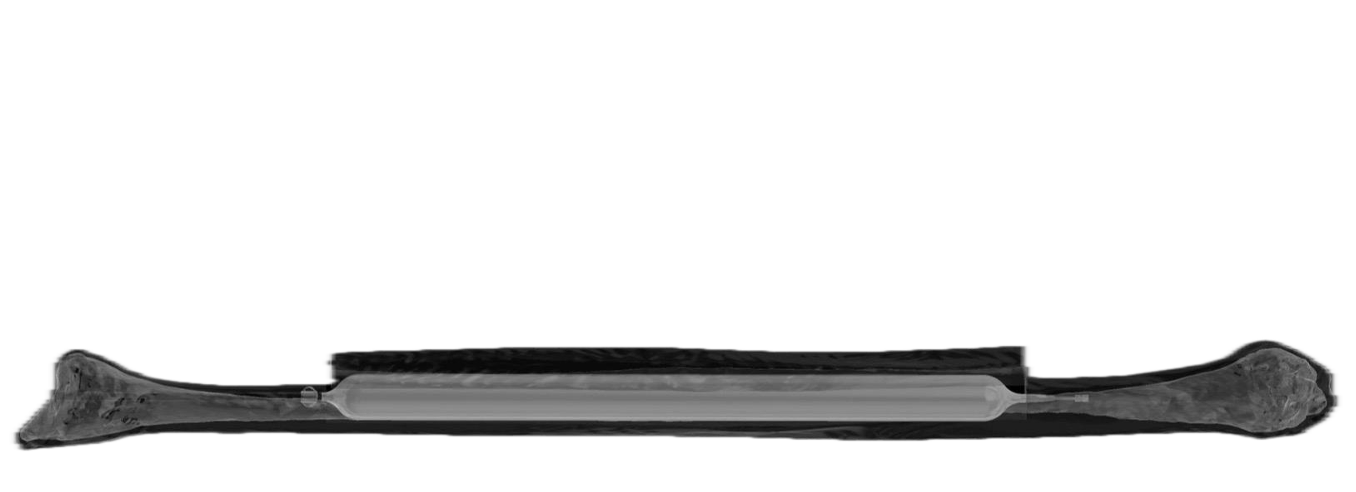 fibulaXpand Logo